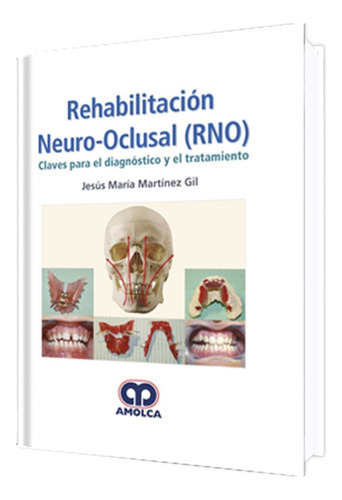 Rehabilitación Neuro-oclusal (rno) Claves Para Diagnóstico.