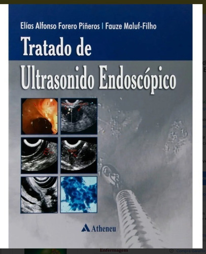 Livro - Tratado De Ultrasonido Endoscópico - Pineros, De Piñeros, Elías Alfonso Forero. Editora Atheneu, Capa Dura Em Português, 1