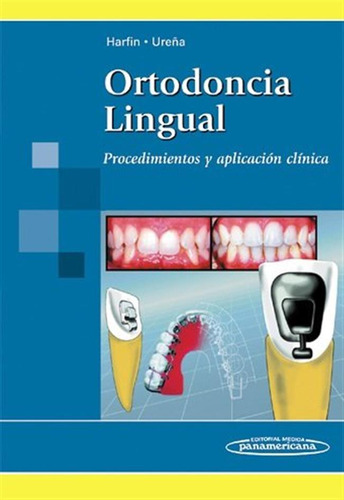 Ortodoncia Lingual - Harfin, Ureña Rodriguez