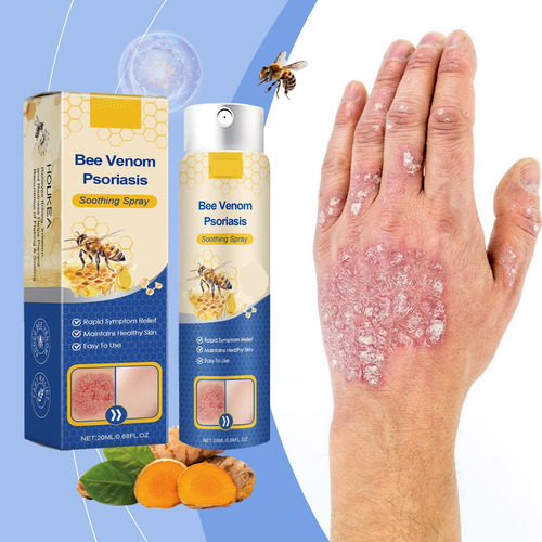 Spray De Cuidado Da Pele, Para Uso Externo Geral Em Pele