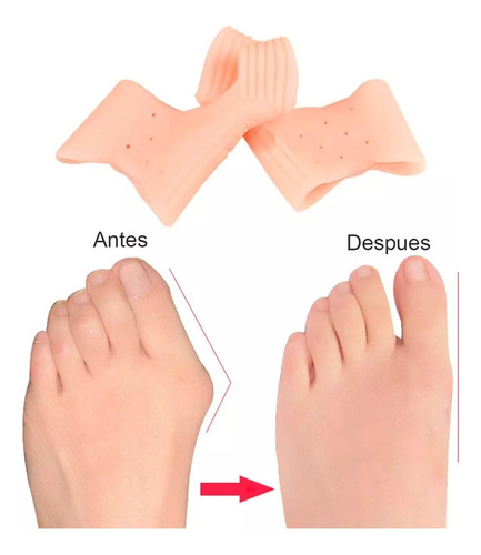 Duo Corrector Silicona Juanete Hallux Valgus Separador Dedo