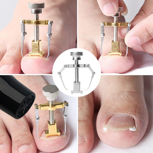 10 Pcs Herramienta Sacar Uñas Enterradas Removedor Uñeros