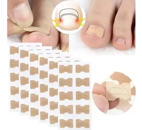 Parche Corrector De Uñas Encarnadas X 10 Unidades