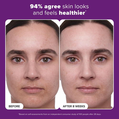 Crema Tratamiento Retinol 1% Con Péptidos Y Vitamina C -