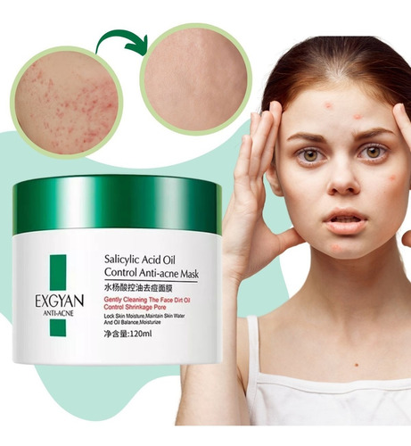 Crema Anti-acné Cuidado Facial Exfoliante Hidratante Skin F