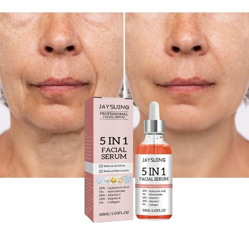 Sérum antiacné con 5% de niacinamida que reduce los poros dilatados 30 ml