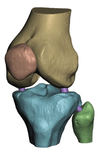 Modelo Anatomico Educativo De Rodilla Impreso En 3d