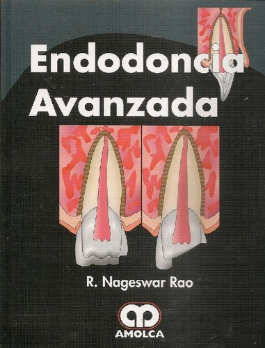 Libro Endodoncia Avanzada De Nageswar R. Rao