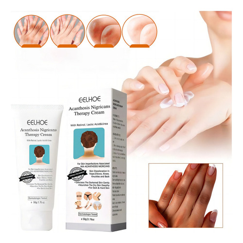 Fixderma Nigrifix Crema Para Acantosis Nigricans Agf, 3 Unid