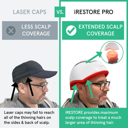 Sistema De Crescimento Capilar A Laser Irestore Professional