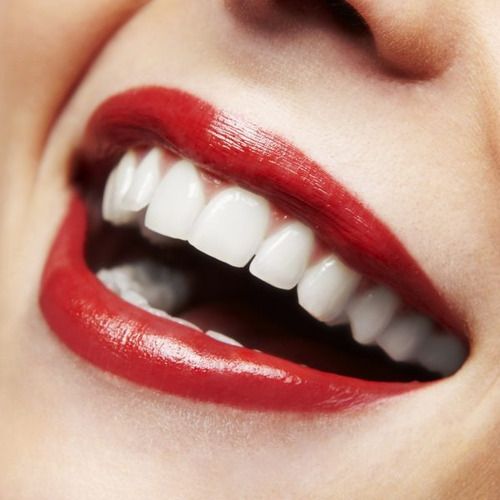 Kit Blanquemiento Ddientes 3 Jeringas X3ml +desensibilizante