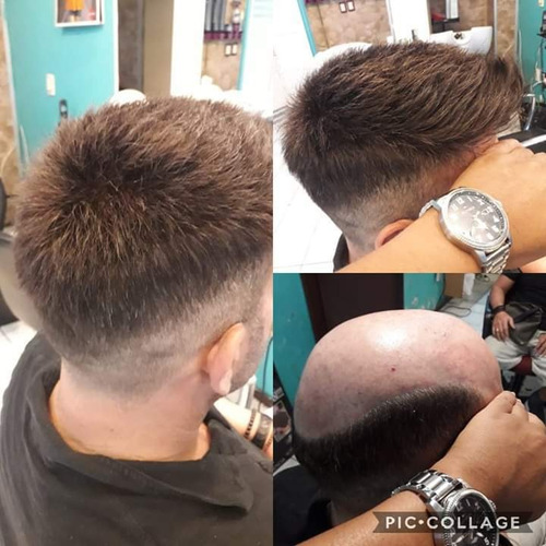 Imagen 4 de 5 de Cinta Para Prótesis Capilares Lace Front De 3 Yardas, Walker