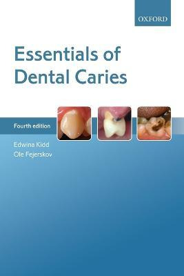 Libro Essentials Of Dental Caries