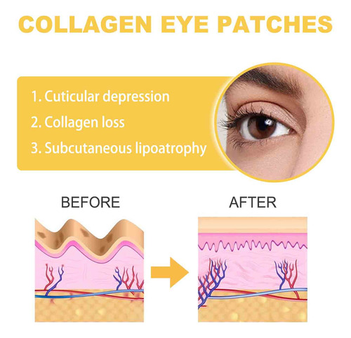 Parches Faciales I Wrinkle Parches Hidratantes Para Arrugas