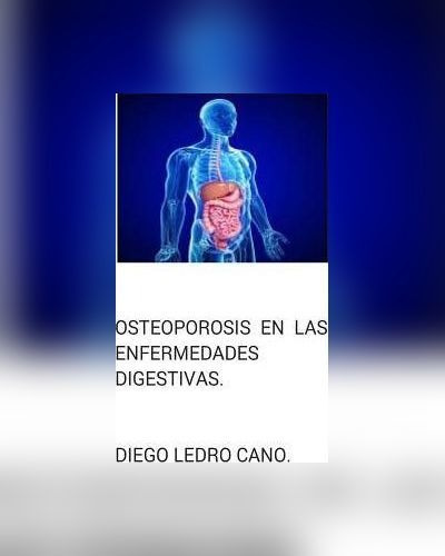 Osteoporosis En Las Enfermedades Digestivas.
