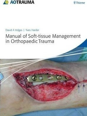 Manual Of Soft-tissue Management In Orthopaedic Trauma - ...