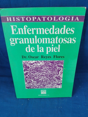 Enfermedades Granulomatosas De La Piel