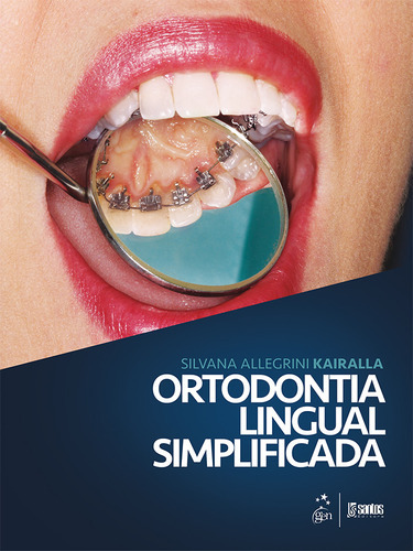 Ortodontia Lingual Simplificada, De Silvana Allegrini Kairalla. Editora Santos, Capa Mole Em Português