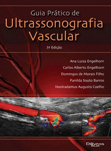 Guia Prático De Ultrassonografia Vascular, De Engelhorn-filho-barros-coelho. Editora Dilivros, Capa Dura Em Português, 2016