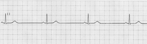 Papel Para Electrocardiógrafo 50 Mm X 30 Mts Cardio Charts