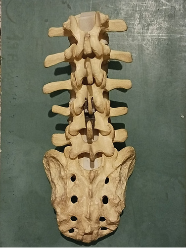 Modelo Anatómico Región Lumbosacra De La Columna Vertebral