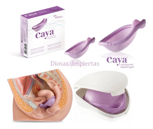Gel Espermicida Del Diafragma Anticonceptivo Caya