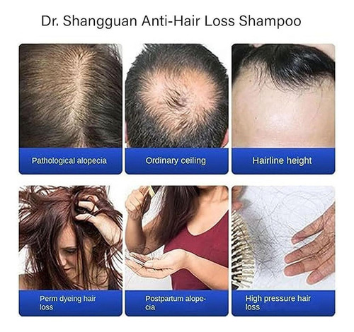 Xinnuo Shampoo Antiqueda De Cabelo E Crescimento Capilar 240