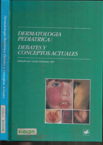 Dermatología Pediátrica Debates Y Conceptos Gelmetti Carlos 