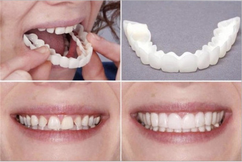 Imagen 2 de 5 de Sonrisa Perfecta Dentadura Dientes Blancos Relucientes Minut