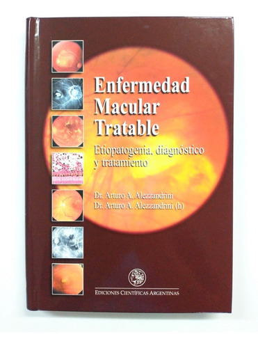 Enfermedad Macular Tratable Etiopatogenia Diagnóstico Tratam