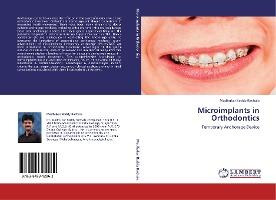 Libro Microimplants In Orthodontics - Madhukar Reddy Rach...