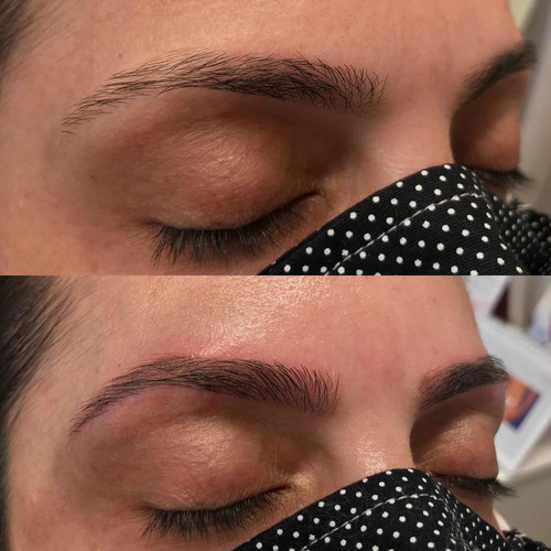 Imagem 3 de 5 de Micropigmentação Sobrancelha/olhos/lábios