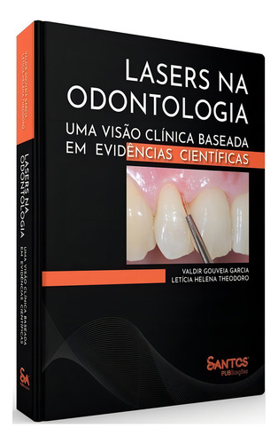 Livro Lasers Na Odontologia Uma Visão Clínica