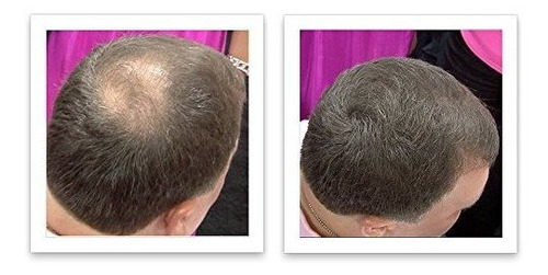 Corrector De Pérdida De Cabello Caboki - Marrón Oscuro