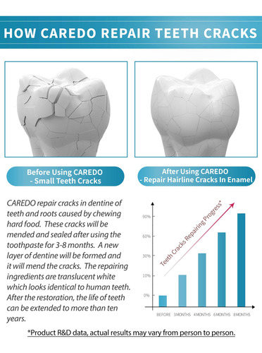 Pasta De Dientes Caredo 100g Para Dientes Agrietados Y
