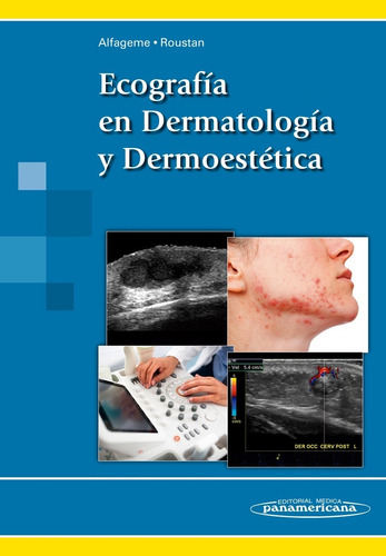 Alfageme Ecografía En Dermatología Y Dermoestética