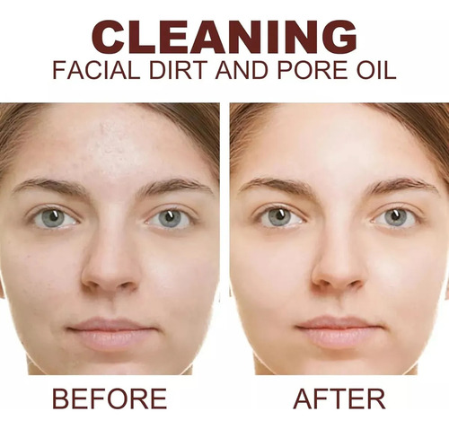 - Gel Exfoliante Purificante, Exfoliante Facial Para Rostro