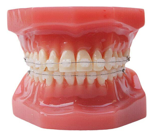 Typodont Dental Con Soportes De Ceramica Ortodoncia Ortodonc