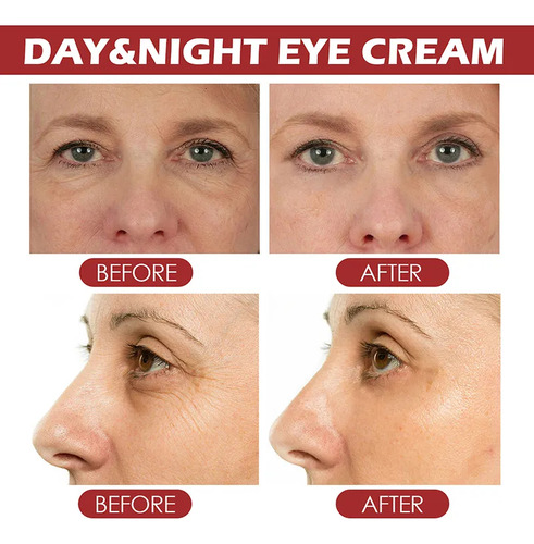 Crema De Ojos Que Elimina Bolsas De Ojos Al Instante Y Elimi
