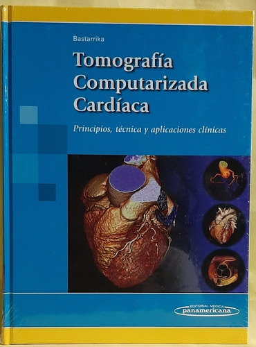 Tomografía Computarizada Cardiaca