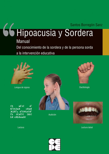 Hipoacusia Y Sordera.manual  -  Borregon Sanz Santos