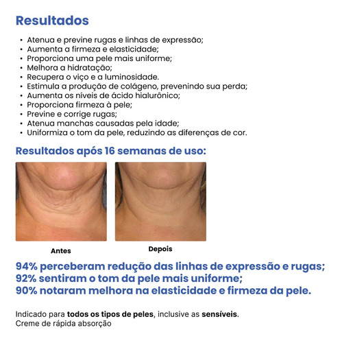 Creamy Skincare Anti-aging Peptide Cream 30g | Estimula A Produção De Colágeno, Atenua Manchas Causadas Pela Idade, Textura Cremosa | Todos Os Tipos De Pele, Noite E Dia