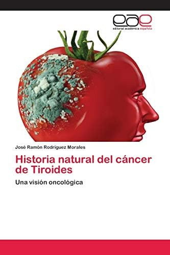 Libro: Historia Natural Del Cáncer De Tiroides: Una Visión O