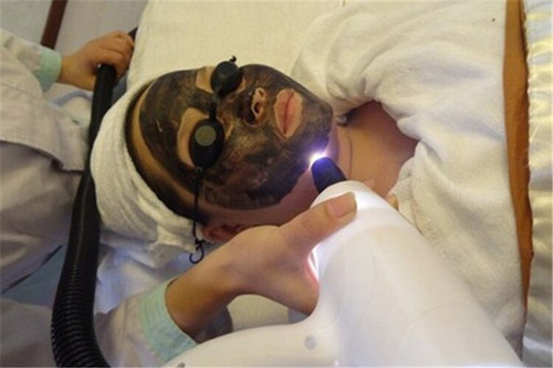 Óculos Proteção Luz Pulsada Laser Led Fototerapia Paciente Cor Preto