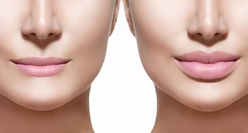 Voluminizador De Labios Lip Care 3d Lidherma