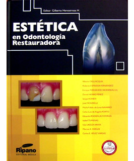 Estética En Odontología Restauradora