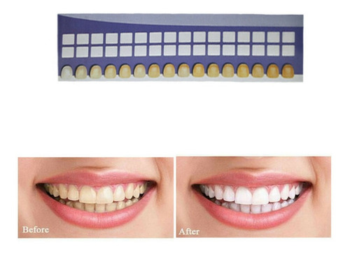 Kit Blanqueador De Dientes Profesional 6 Jeringa Luz Led Usa