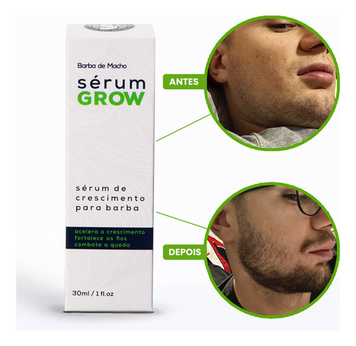 Kit Fortificante Shampoo Sh Force+ E Sérum Grow Cabelo Barba