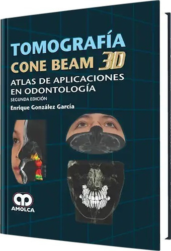 Tomografía Cone Beam 3d Atlas De Aplicaciones En Odontol 2ed