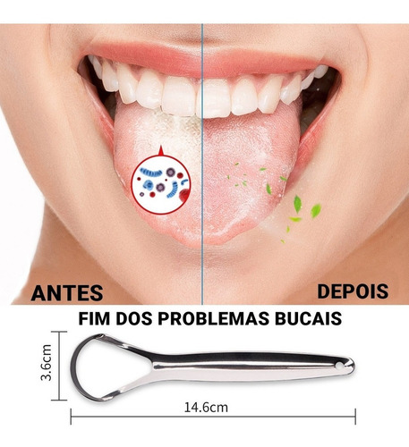 Imagem 7 de 10 de Limpadora Raspadora De Língua Em Aço Inoxidável Higiene Boca